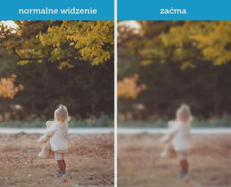 Prawo jazdy jednooczność